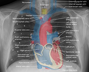 300px-Mediastinal_structures_on_chest_X-ray_annotated